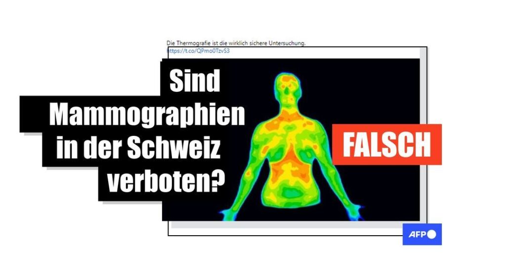Es gibt kein Mammographie-Verbot in der Schweiz - Featured image