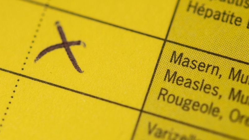 Masern können schweren Krankheitsverlauf verursachen